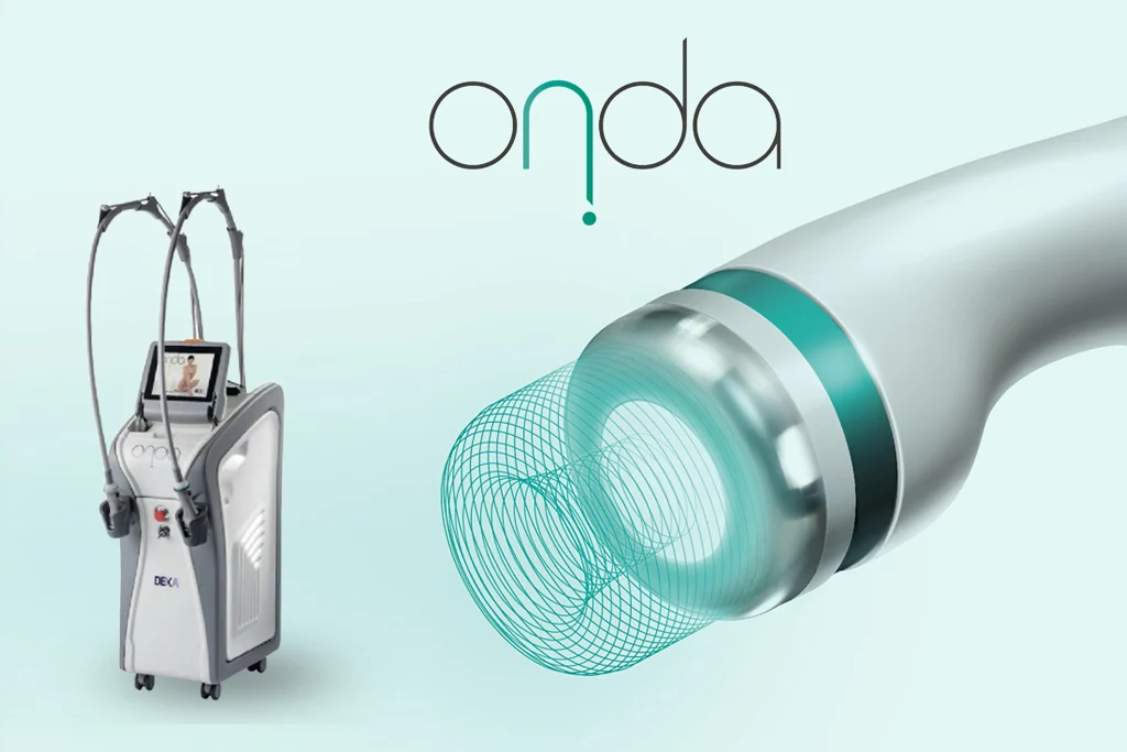 Onda program