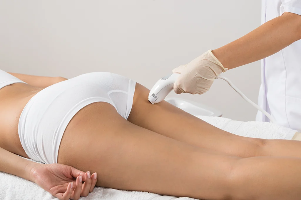 toning laser