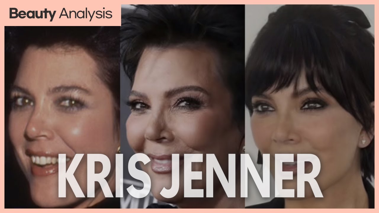 Kris Jenner Procedures, Beauty Analysis (by Eterna Clinic)